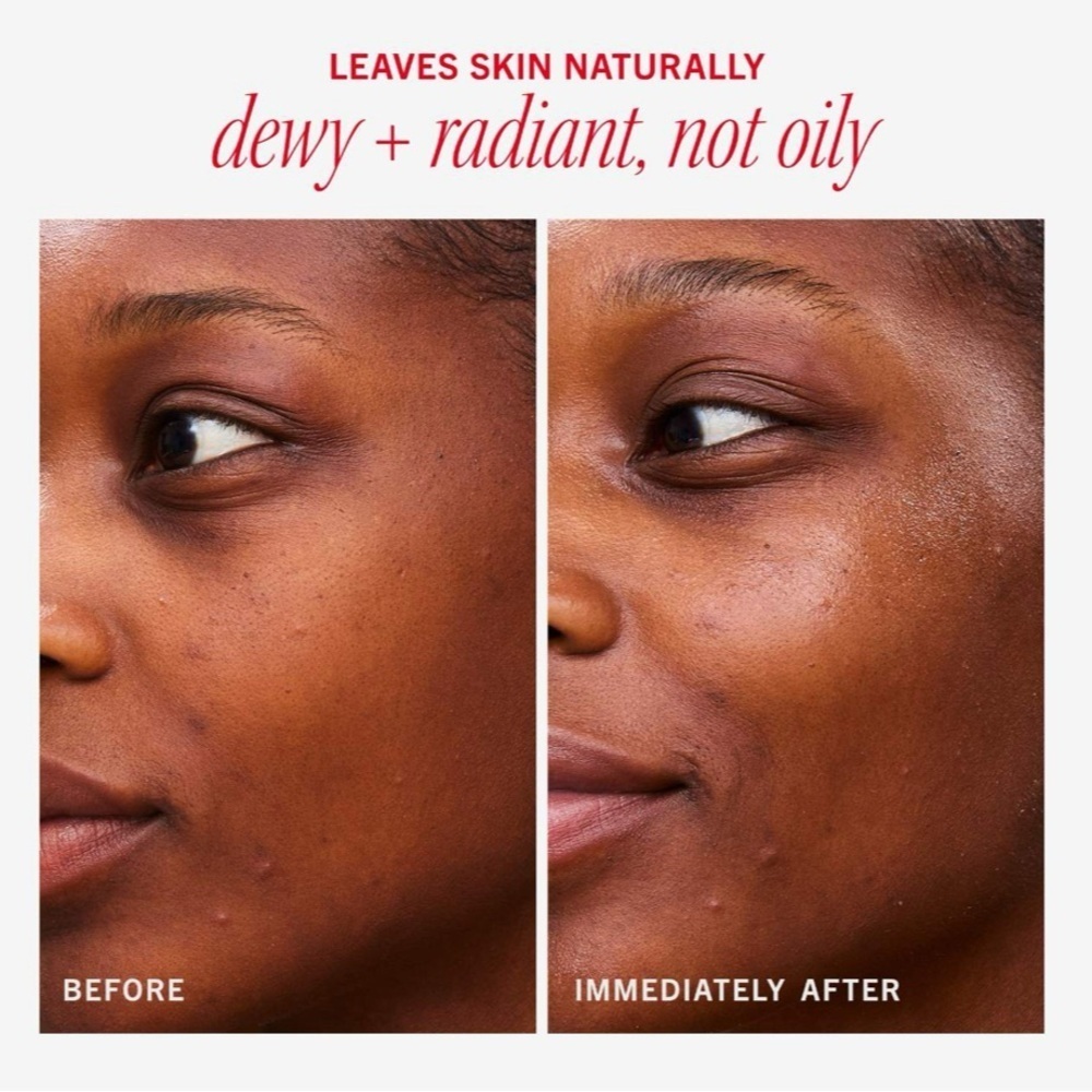 First Aid Beauty Hydrating Dewy Gel Cream - Picture 6 of 10